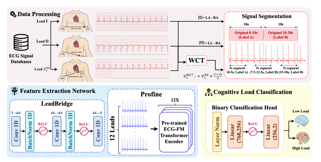 CogAdapt pipeline with data processing, LeadBridge, ECG-FM encoder, and cognitive load classification head.